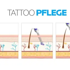 Illustration zeigt, wie Pigmente in die Dermis eingebracht werden. Wichtig für die tattoo pflegen nach dem stechen.