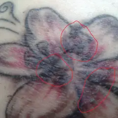 Nahaufnahme eines verheilenden Tattoos einer Blume. Rote Kreise markieren Bereiche mit Krustenbildung, die auf die tattoo kruste hinweisen.