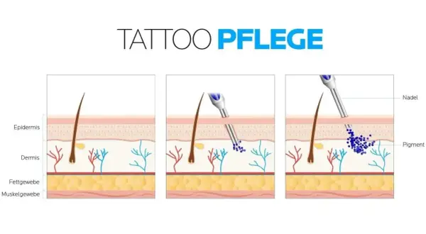 Illustration zeigt, wie Pigmente in die Dermis eingebracht werden. Wichtig für die tattoo pflegen nach dem stechen.