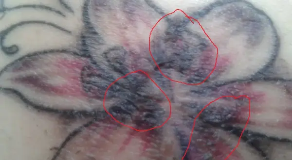 Nahaufnahme eines verheilenden Tattoos einer Blume. Rote Kreise markieren Bereiche mit Krustenbildung, die auf die tattoo kruste hinweisen.