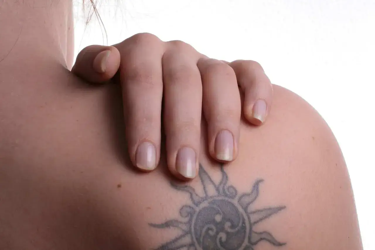 Schulter mit Tattoo und einem kleinen Pickel, der sich auf dem Kunstwerk abzeichnet.