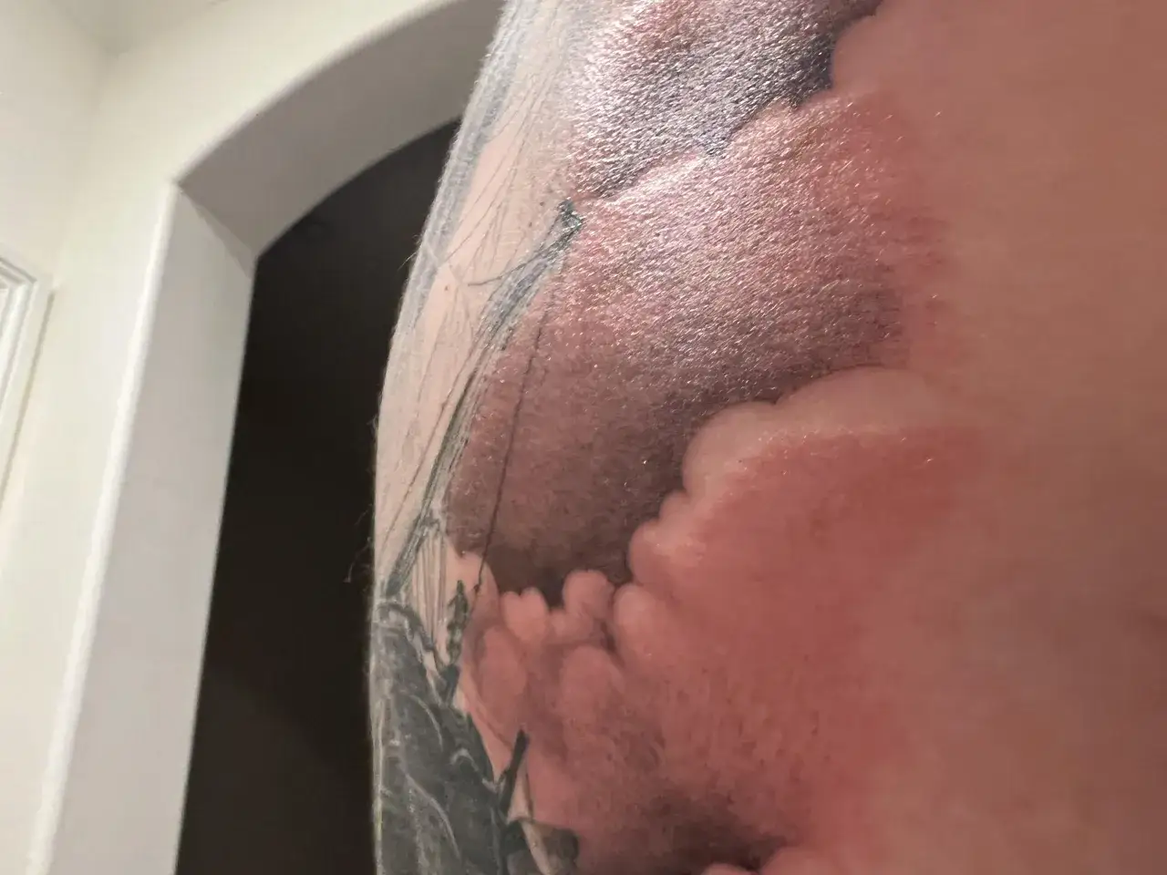 Hautrötung und Schwellung um ein Tattoo herum, das aussieht, als ob es brennt.