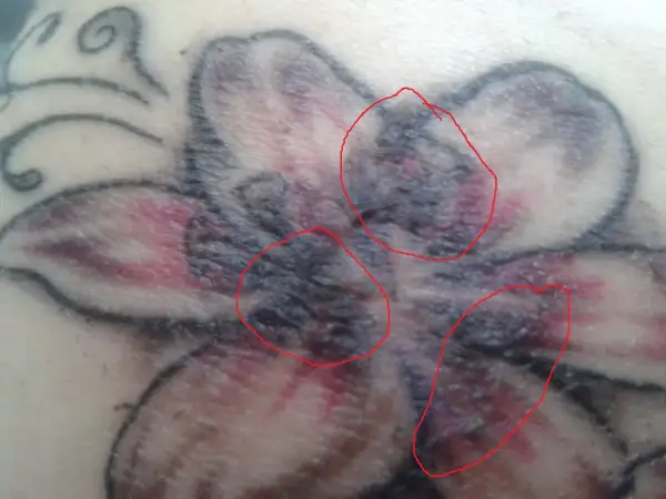 Nahaufnahme eines verheilenden Tattoos einer Blume. Rote Kreise markieren Bereiche mit Krustenbildung, die auf die tattoo kruste hinweisen.